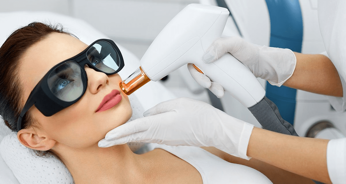 Rajeunissement du visage