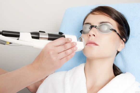 effectuer une procédure de rajeunissement de la peau au laser